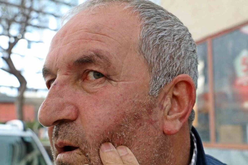 Kulak zarını patlatana kadar dövdüler: ‘Bu değilmiş’ deyip gittiler