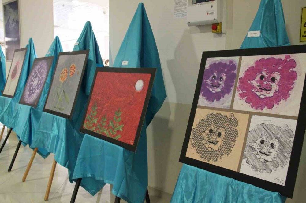 Hastalıklı dokular sanat eserine dönüştü