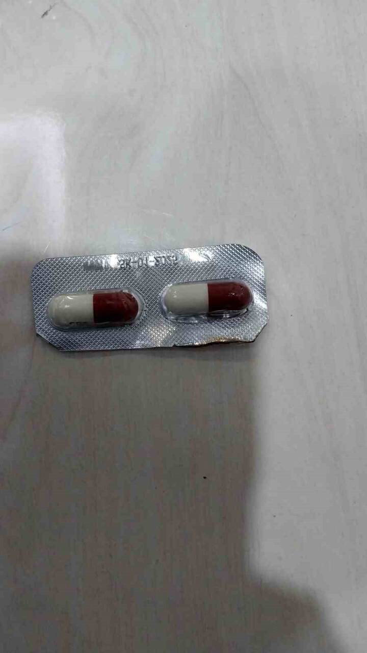 Aracım motor kısmına zulalamışlar: 7 parça halinde ortaya çıktı