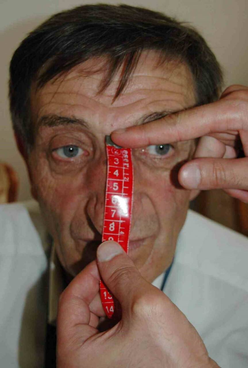 Dünyanın en uzun burunlu adamı hayatını kaybetti