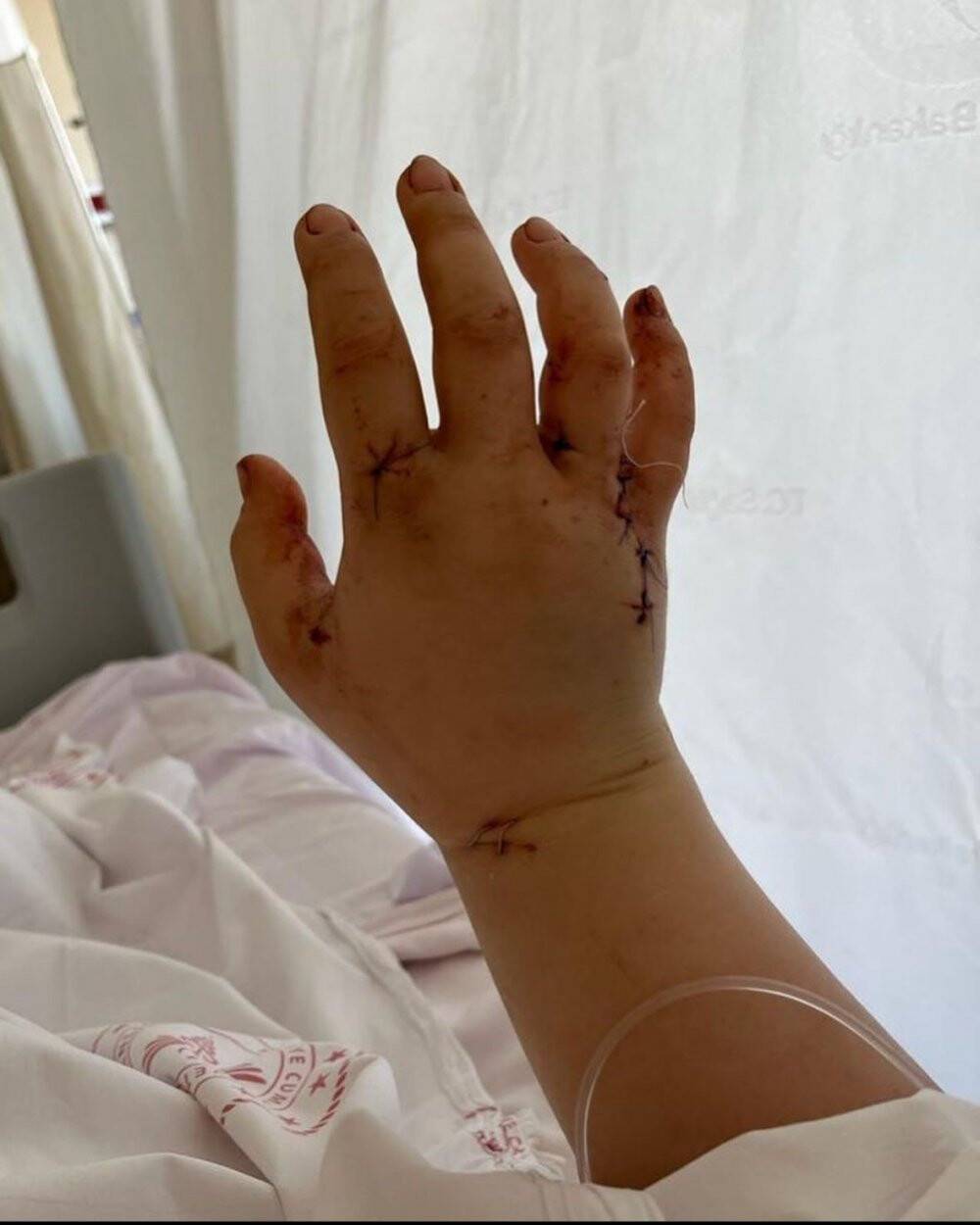 Fenomen, eşi tarafından 32 yerinden bıçaklanmıştı, gözlerini açtı