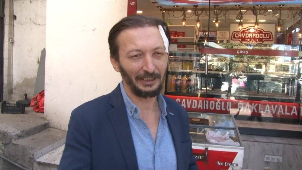 ‘Ne bakıyorsun’ kafasından bıçakladılar: 28 dikiş atıldı