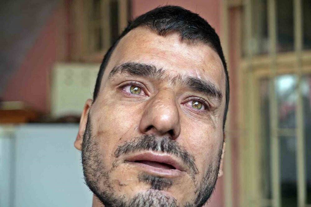 2 aylık ‘Can’ bebek alevler arasında kaldı