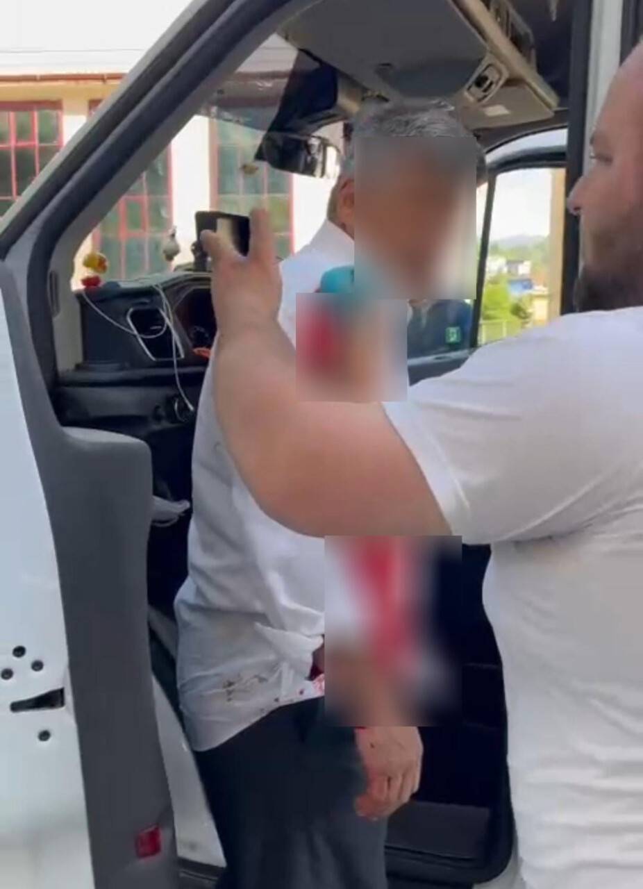 Yol verme kavgası kanlı bitti: 1 ölü, 1 yaralı