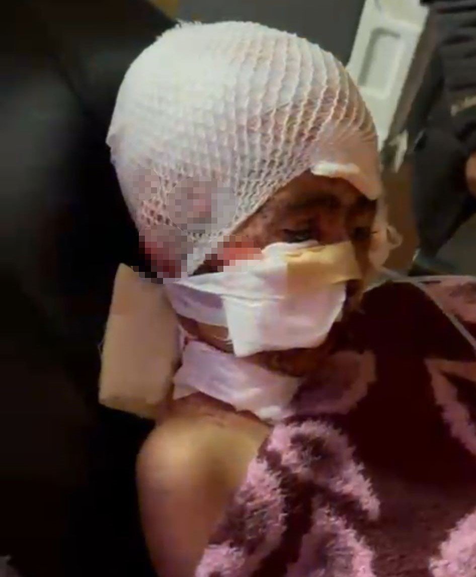 Çocuğu köpek saldırısına uğrayan babanın feryadı: "Bu işe bir çözüm bulun. Artık anne ve babalar gözyaşı dökmesin"