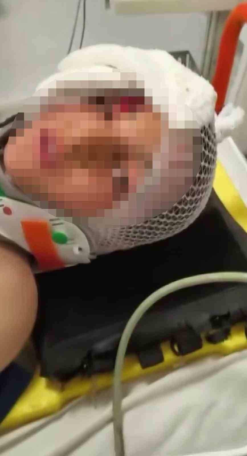 Dayısının taşla yaralayıp toprağa gömdüğü çocuk, polisin 200 kamera kaydını izlemesiyle bulundu