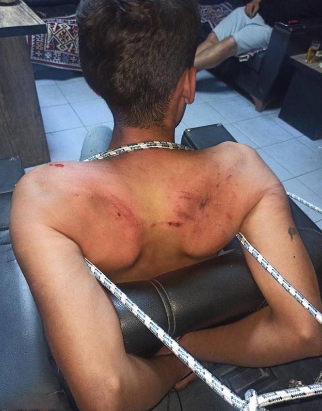 Hamam böceği yedirilen gencin dosyasında karar: Yağmadan beraat, hürriyeti tehditten 6 yıl 12 ay ceza