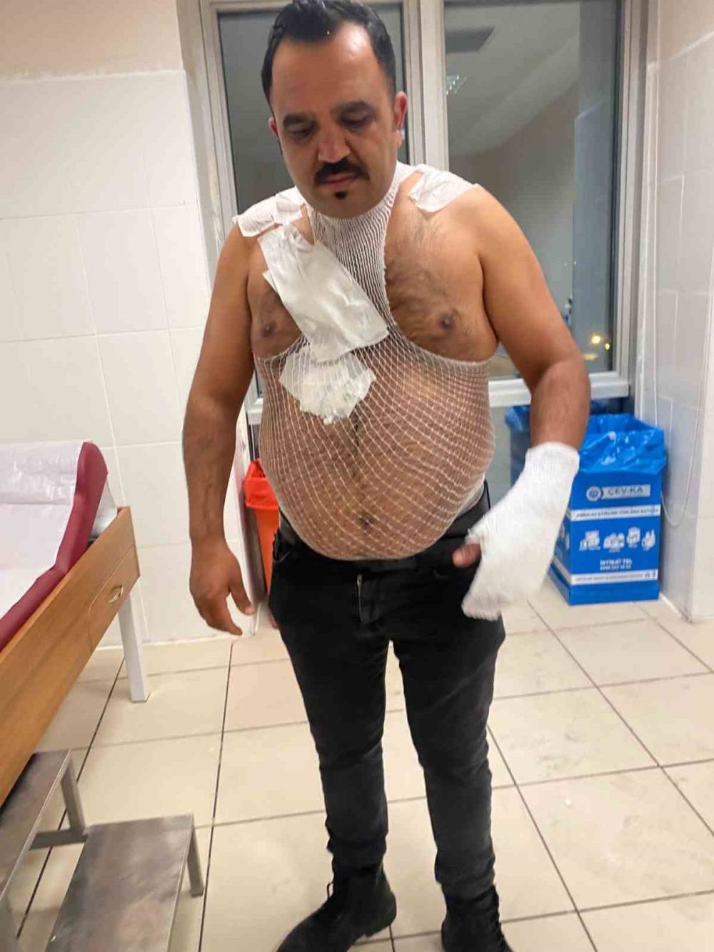 Meşhur tostçu, soğuk havada şov yapmak isterken kendini yaktı