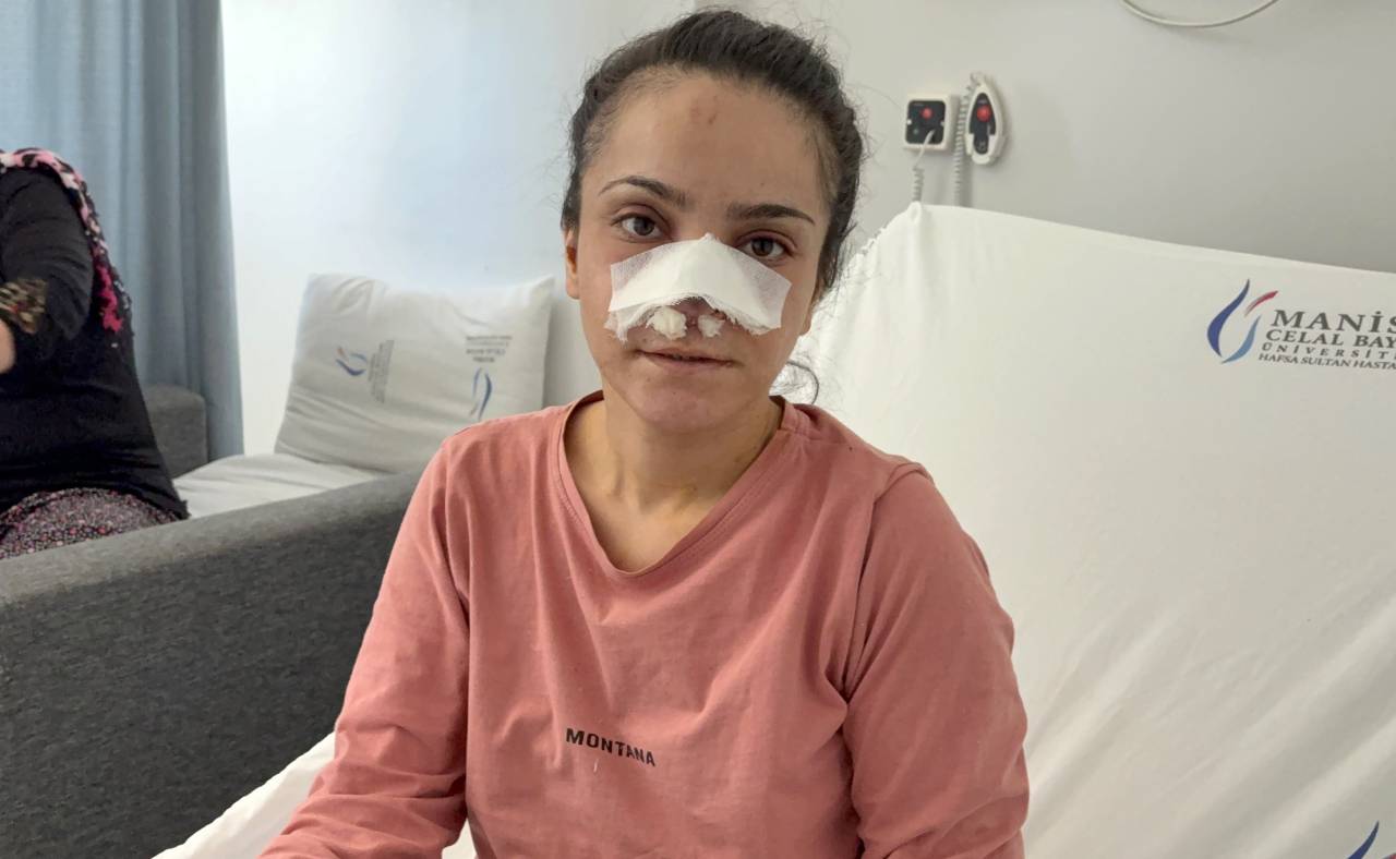 kavga-ettigi-esinin-burnunu-isirarak-kopardi-1.jpg